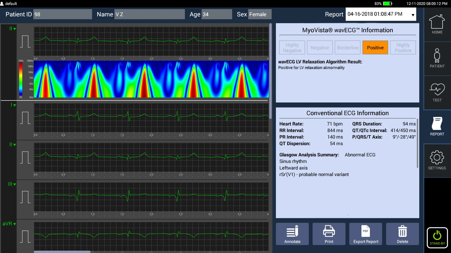 MyoVista® wavECG™ Device - AI-Optimized ECG Acquisition